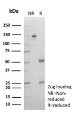 SDS-PAGE Analysis of Purified IgG1 Immunoglobulin Recombinant Mouse Monoclonal Antibody (rIGHG1/13035). Confirmation of Purity and Integrity of Antibody.