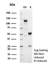 SDS-PAGE Analysis of purified recombinant CD25/IL2RA antibody (clone IL2RA/9378R). Confirmation of Purity and Integrity of Antibody.