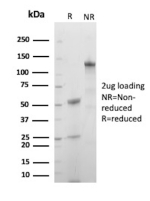 SDS-PAGE Analysis of purified recombinant TNFRSF9/4-1BB antibody (clone rS16). Confirmation of Purity and Integrity of Antibody.