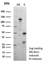 SDS-PAGE analysis of purified Suprabasal Keratin/Cytokeratin 10 antibody (clone KRT10/9605R). Confirmation of Purity and Integrity of Antibody.