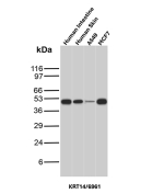 Western blot analysis of Human Intestine, Human Skin, A549 and MCF7 lysates using Cytokeratin 14 Mouse Monoclonal Antibody (KRT14/6961).
