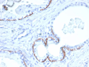 Immunohistochemistry analysis of KRT14/Keratin 14 in human prostate tissue. Formalin-fixed, paraffin-embedded human prostate tissue was stained using KRT14/Keratin 14 antibody (clone KRT14/6961). Brown chromogenic signal is observed in basal epithelial cells lining prostatic glands, with staining localized to the cytoplasmic compartment, while surrounding luminal epithelial cells and stromal tissue show little to no staining. This staining pattern is consistent with basal cell-restricted expression of Cytokeratin 14 in prostate epithelium.