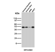 Western blot analysis of KRT14/Keratin 14 antibody (clone KRT14/6961) in human samples. Total protein lysates from human intestine, human skin, human A549 cells, and human MCF7 cells were analyzed by SDS-PAGE and immunoblotting using Cytokeratin 14 mouse monoclonal antibody (clone KRT14/6961). A prominent band is detected at the ~ 53 kDa predicted molecular weight of Keratin 14, consistent with Cytokeratin 14 expression in basal-type epithelial samples, with strong signal observed in human skin and detectable signal in A549 cells, while lower or minimal signal is observed in intestine and MCF7 lysates. Band intensity differences are consistent with known tissue- and cell type-specific expression patterns of Cytokeratin 14.