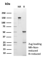 SDS-PAGE analysis of purified LGALS9 / Galectin 9 antibody (clone LGALS9/7689). Confirmation of Purity and Integrity of Antibody.