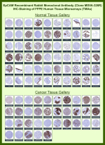 Immunohistochemistry analysis of recombinant CD326 / Epithelial cell adhesion molecule antibody (clone MSVA-326R) in human normal and cancer tissues. Formalin-fixed, paraffin-embedded human tissue microarrays were stained using recombinant CD326/Epithelial cell adhesion molecule antibody (clone MSVA-326R). Strong membranous staining is observed in a wide range of normal epithelial tissues including colon mucosa, small intestine, stomach, prostate, endometrium, and other glandular epithelia, while non-epithelial tissues such as skeletal muscle and lymphoid structures show minimal to absent staining. In cancer tissues, prominent membranous positivity is seen in multiple carcinomas including colorectal adenocarcinoma, breast carcinoma, lung adenocarcinoma, ovarian carcinoma, pancreatic carcinoma, and urothelial carcinoma. Mesenchymal tumors and non-epithelial malignancies show little to no staining. The staining pattern aligns with Human Protein Atlas expression data and reflects epithelial lineage-restricted expression of CD326/EpCAM. 