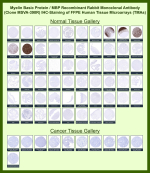 Myelin basic protein Rabbit Recombinant Monoclonal Antibody (MSVA-390R) tested on many normal and cancer tissues. The immunohistochemistry staining in these tissues aligns with the expression data in Human Protein Atlas. <br><br>Manual Protocol: Freshly cut sections should be used (less than 10 days between cutting and staining). Heat-induced antigen retrieval for 5 minutes in an autoclave at 121oC in pH 7.8 Target Retrieval Solution buffer. Apply the antibody at a dilution of 1:150 at 37oC for 60 minutes. Visualization of bound antibody by the EnVision Kit (Dako, Agilent) according to the manufacturer