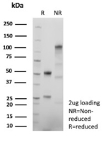 SDS-PAGE Analysis Purified MCM4 Recombinant Rabbit Monoclonal Antibody (MCM4/13209R). Confirmation of Purity and Integrity of Antibody.