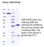 SDS-PAGE Analysis of purified recombinant Minichromosome maintenance protein 5/MCM5 antibody (clone rMCM5/13646). Confirmation of Purity and Integrity of Antibody.