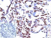 IHC analysis of formalin-fixed, paraffin-embedded human colon tissue using recombinant Minichromosome maintenance protein 5/MCM5 antibody (recombinant mouse monoclonal clone rMCM5/13646). Strong nuclear brown chromogenic staining is observed in proliferating colonic epithelial cells, consistent with nuclear localization of Minichromosome maintenance protein 5, while surrounding non-proliferative cells show reduced staining. Inset: PBS used in place of primary antibody as secondary-only negative control. Heat-induced epitope retrieval was performed by boiling tissue sections in 10mM Tris with 1mM EDTA, pH 9.0, for 45 minutes at 95oC followed by cooling at room temperature for 20 minutes.
