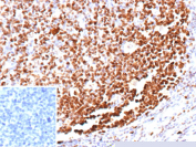 Immunohistochemistry of recombinant MCM complex component 5 antibody in formalin-fixed, paraffin-embedded human tonsil. Strong nuclear brown staining is observed in proliferating lymphoid cells within germinal centers, consistent with MCM5 expression in actively cycling cells, while surrounding non-proliferating cells show weaker or absent staining. Inset: PBS used in place of primary antibody as a negative control shows no specific staining. Heat-induced epitope retrieval was performed by boiling tissue sections in 10mM Tris with 1mM EDTA, pH 9.0, for 45 minutes at 95oC followed by cooling at room temperature.