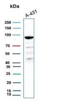 Western Blot analysis of human A431 cell lysates using recombinant MCM complex component 5/MCM5 antibody (clone MCM5/13320R). Expected molecular weight: 80~90 kDa.