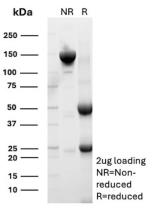 SDS-PAGE Analysis of purified recombinant MIC2/CD99 antibody (clone MIC2/9939R). Confirmation of Purity and Integrity of Antibody.