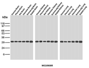 Western blot analysis of Human Kidney, Mouse Kidney, Rat Kidney, Human Brain, Mouse Brain, Rat Brain, Human Lung, Mouse Lung, Rat Lung tissue lysates and Jurkat cell lysates using recombinant MIC2/CD99 antibody (MIC2/9939R). Expected molecular weight: 16-32 kDa depending on the level of glycosylation.