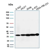 Western blot analysis of human K-562, MCF7, A549, A-431 & MDA-MB-231 cell lysates using recombinant MIC2/CD99 antibody (clone MIC2/9939R). Expected molecular weight: 16-32 kDa depending on the level of glycosylation.