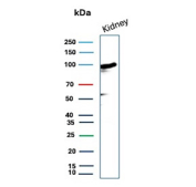 Western Blot analysis of human kidney lysate using recombinant MME/Membrane metalloendopeptidase antibody (clone MME/12800R). Routinely observed at ~100 kDa.
