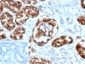 Immunohistochemistry of recombinant MME/Membrane metalloendopeptidase antibody (clone MME/12800R) in formalin-fixed, paraffin-embedded human kidney tissue shows strong membranous brown chromogenic staining in renal tubular epithelial cells, consistent with known CD10 expression in proximal tubules. Nuclei are counterstained blue. Inset: PBS used in place of primary antibody as a negative control shows no specific staining. Heat-induced epitope retrieval was performed by boiling tissue sections in 10mM Tris with 1mM EDTA, pH 9.0, for 45 minutes at 95oC followed by cooling at room temperature for 20 minutes.