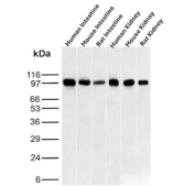 Western Blot Analysis of Human Intestine, Mouse Intestine, Rat Intestine, Human kidney, Mouse kidney and Rat kidney tissue lysates using recombinant MME/CD10 antibody (clone MME/12957R). Routinely observed at ~100 kDa.