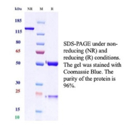 SDS-PAGE Analysis of purified recombinant MME/CD10 antibody (clone MME/12925R). Confirmation of Purity and Integrity of Antibody.