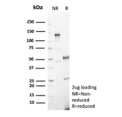 SDS-PAGE analysis of purified recombinant Gelatinase B/MMP9 antibody (clone r15W2). Confirmation of Purity and Integrity of Antibody.