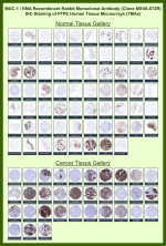 Immunohistochemistry analysis of Epithelial Membrane Antigen / MUC1 antibody (clone MSVA-672R) in human tissue microarrays. Recombinant Epithelial Membrane Antigen / MUC1 antibody (clone MSVA-672R) was evaluated on FFPE human normal and cancer tissue microarrays, demonstrating membranous and cytoplasmic brown chromogenic staining in epithelial tissues and epithelial-derived tumors consistent with known MUC1 expression patterns, while non-epithelial tissues show minimal staining. The staining distribution observed across normal and malignant specimens is consistent with publicly available expression data.