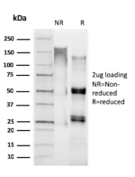 SDS-PAGE analysis of purified ASGP-2/MUC4 antibody (clone MUC4/2863). Confirmation of Purity and Integrity of Antibody.
