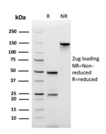 SDS-PAGE analysis of purified recombinant Sialomucin Complex Subunit 4 antibody (clone MUC4/8660R). Confirmation of Purity and Integrity of Antibody.