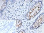 Immunohistochemistry analysis of recombinant Sialomucin Complex Subunit 4 / MUC4 antibody (clone MUC4/8660R) in human colon tissue. Formalin-fixed, paraffin-embedded human colon section shows membranous and apical cytoplasmic brown chromogenic staining in epithelial cells lining glandular structures, consistent with MUC4 expression, while surrounding stromal cells exhibit minimal staining and nuclei appear blue. The inset shows PBS used in place of primary antibody as a negative control with no specific staining observed. Heat-induced epitope retrieval was performed by heating tissue sections in 10 mM Tris with 1 mM EDTA, pH 9.0, for 45 minutes at 95oC followed by cooling at room temperature for 20 minutes prior to staining.