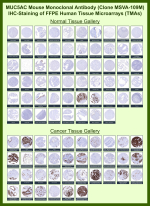 Immunohistochemistry analysis of Foveolar Mucin / MUC5AC antibody (clone MSVA-109M) in human tissue microarrays. Recombinant Foveolar Mucin / MUC5AC antibody (clone MSVA-109M) was evaluated on FFPE human normal and cancer tissue microarrays, demonstrating cytoplasmic brown chromogenic staining in gastric foveolar epithelium and mucin-producing epithelial tumors consistent with known MUC5AC expression patterns, while most non-mucinous tissues show minimal staining. The observed staining distribution across normal and malignant specimens aligns with publicly available protein expression data.