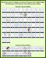 Mucin-6 Rabbit Recombinant Monoclonal Antibody (MSVA-806R) tested on many normal and cancer tissues. The immunohistochemistry staining in these tissues aligns with the expression data in Human Protein Atlas. <br><br>Manual Protocol: Freshly cut sections should be used (less than 10 days between cutting and staining). Heat-induced antigen retrieval for 5 minutes in an autoclave at 121oC in pH 7.8 Target Retrieval Solution buffer. Apply the antibody at a dilution of 1:150 at 37oC for 60 minutes. Visualization of bound antibody by the EnVision Kit (Dako, Agilent) according to the manufacturer