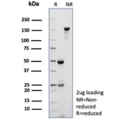 SDS-PAGE analysis of purified Beta-Myosin Heavy Chain/MYH7 antibody (clone MYH7/9969R). Confirmation of Purity and Integrity of Antibody.