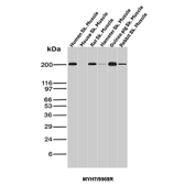 Western blot analysis of Beta-Myosin Heavy Chain / MYH7 antibody (clone MYH7/9969R). Skeletal muscle tissue lysates from human, mouse, rat, hamster, guinea pig, and rabbit were resolved by SDS-PAGE and probed with Beta-Myosin Heavy Chain / MYH7 antibody (clone MYH7/9969R), demonstrating a prominent immunoreactive band at approximately 220 kDa consistent with the predicted molecular weight of MYH7. The observed band corresponds to beta-myosin heavy chain expressed in slow-twitch skeletal muscle fibers across species.