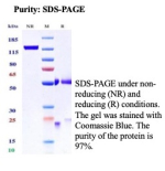 SDS-PAGE Analysis of Purified CD66c/CEACAM6 antibody (clone CEACAM6/13372R). Confirmation of Purity and Integrity of Antibody.
