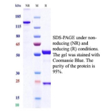 SDS-PAGE analysis of purified nm23-H2/NME2 antibody (clone NME2/12953R). Confirmation of Purity and Integrity of Antibody.