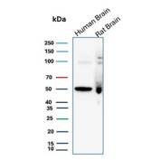 Western Blot Analysis of NTRK3 / TrkC antibody (clone NTRK3/8796). Human brain and rat brain tissue lysates show a dominant immunoreactive band at approximately 50 kDa, with additional higher molecular weight species visible in rat brain. The predicted molecular weight of full-length TrkC is approximately 90-95 kDa; however, NTRK3 undergoes alternative splicing and proteolytic processing, generating truncated isoforms lacking portions of the intracellular kinase domain that migrate at lower apparent molecular weights. The ~50 kDa band is consistent with a truncated TrkC isoform, while the higher bands likely represent full-length and differentially glycosylated receptor species, which commonly migrate above their predicted molecular weight due to N-linked glycosylation of the extracellular domain.