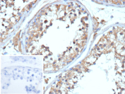 Immunohistochemistry analysis of SERPINE1 / PAI-1 antibody in human testis. Formalin-fixed, paraffin-embedded human testis tissue was stained with SERPINE1 / PAI-1 antibody (clone rTJA6). HRP-DAB brown chromogenic signal is observed predominantly in the cytoplasm of seminiferous tubule-associated cells, with staining localized to germ cells and surrounding supporting cells, while nuclei are counterstained blue. The staining pattern is consistent with cytoplasmic localization of Serpin family E member 1 in testicular tissue. The inset image shows PBS used instead of primary antibody, demonstrating absence of specific HRP-DAB brown staining and confirming staining specificity. Heat-induced epitope retrieval was performed in 10 mM Tris with 1 mM EDTA, pH 9.0, for 45 minutes at 95oC followed by cooling at room temperature for 20 minutes prior to antibody incubation.