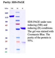SDS-PAGE Analysis of PCNA Proliferation Marker antibody (PCNA/13725R) of Purity and Integrity of Antibody.