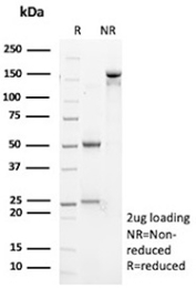 SDS-PAGE Analysis of Purified MDR1/Multidrug resistance protein 1 antibody (ABCB1/9307). Confirmation of Purity and Integrity of Antibody.