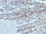Immunohistochemistry analysis of MDR1 / Multidrug resistance protein 1 antibody in human adrenal gland. FFPE human adrenal gland tissue was stained with MDR1 / Multidrug resistance protein 1 antibody (clone ABCB1/9307). HRP-DAB brown chromogenic signal is observed predominantly along the plasma membrane of adrenal cortical cells, producing strong circumferential membranous staining consistent with the known localization of the p170 ABCB1 drug efflux transporter. Cortical cell nests demonstrate prominent membrane-associated signal, while surrounding stromal components show minimal background staining. The inset negative control using PBS instead of primary antibody shows no specific brown staining. Nuclei are counterstained blue. Heat-induced epitope retrieval was performed by boiling tissue sections in 10 mM Tris with 1 mM EDTA, pH 9.0, for 45 minutes at 95oC followed by cooling at room temperature prior to antibody incubation.