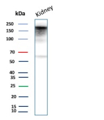 Western blot analysis of human kidney tissue lysate using p170 / MDR1 Mouse Monoclonal Antibody (ABCB1/9307).