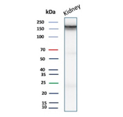 Western blot analysis of CD243 / Multidrug Resistance 1 antibody in human kidney. Western blot was performed using CD243 / Multidrug Resistance 1 antibody (clone ABCB1/9309) on human kidney tissue lysate. A prominent immunoreactive band is detected at approximately 170 kDa, consistent with the predicted molecular weight of ABCB1, also known as p170 or P-glycoprotein. The band displays a slightly diffuse appearance, which is consistent with the heavily glycosylated nature of Multidrug Resistance 1 and its membrane-associated processing. The detected signal corresponds to the predicted molecular weight under reducing conditions. Strong expression in kidney tissue aligns with the known enrichment of ABCB1 in proximal tubular epithelial cells, supporting specific detection of endogenous CD243.
