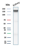 Western blot analysis of human kidney tissue lysate using p170 / MDR1 Mouse Monoclonal Antibody (ABCB1/9309).