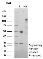 SDS-PAGE Analysis of Purified CD243/Multidrug Resistance 1 antibody (ABCB1/9309). Confirmation of Purity and Integrity of Antibody.