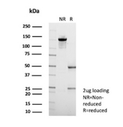 SDS-PAGE Analysis of Purified Alpha-1 Proteinase Inhibitor/AAT antibody (clone AAT/4487).