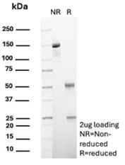SDS-PAGE Analysis of Purified PI5/Peptidase Inhibitor 5 antibody (SERPINB5/12558). Confirmation of Purity and Integrity of Antibody.
