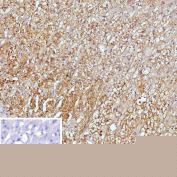 Immunohistochemistry analysis of PI5 / SERPINB5 antibody (clone SERPINB5/12558) in human adrenal gland tissue. Sections of formalin-fixed, paraffin-embedded human adrenal gland show cytoplasmic and membranous brown chromogenic staining in adrenal cortical cells, while nuclei are counterstained blue. The inset image represents a negative control in which PBS was used instead of the primary antibody, demonstrating absence of specific staining. Heat induced epitope retrieval was performed by boiling tissue sections in 10mM Tris with 1mM EDTA, pH 9.0, for 45 minutes at 95oC followed by cooling at room temperature for 20 minutes before immunostaining.