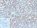 Formalin-fixed, paraffin-embedded human tonsil stained with BCOR Recombinant Rabbit Monoclonal Antibody (BCOR/13087R). Inset: PBS instead of primary antibody; secondary only negative control.