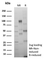 SDS-PAGE Analysis of Purified BCOR Recombinant Rabbit Monoclonal Antibody (BCOR/13087R). Confirmation of Purity and Integrity of Antibody.
