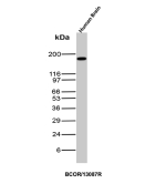 Western Blot Analysis of human brain tissue lysate using BCOR Recombinant Rabbit Monoclonal Antibody (BCOR/13087R).