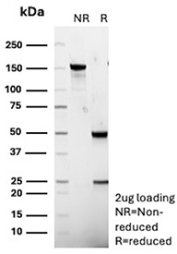 SDS-PAGE Analysis of Purified PTGS2/Prostaglandin-endoperoxide synthase 2 antibody (r4H12). Confirmation of Purity and Integrity of Antibody.