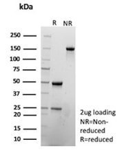 SDS-PAGE Analysis of Purified CS1/SLAMF7 antibody (SLAMF7/13123). Confirmation of Purity and Integrity of Antibody.